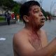 Nuevas víctimas mortales calientan la toma indígena de Lima