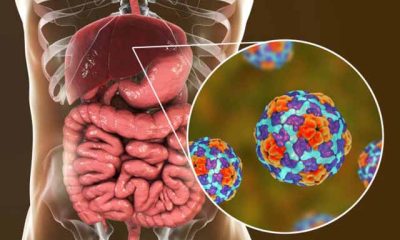 Hepatitis: un grave problema de salud pública