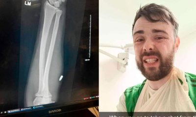 Impactante Incidente: Jugador de Fútbol Recibe Disparo en Pleno Partido en Irlanda