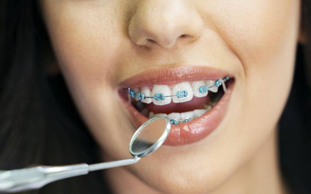La ortodoncia combina ciencia y arte para mejorar la salud bucal y la estética dental.